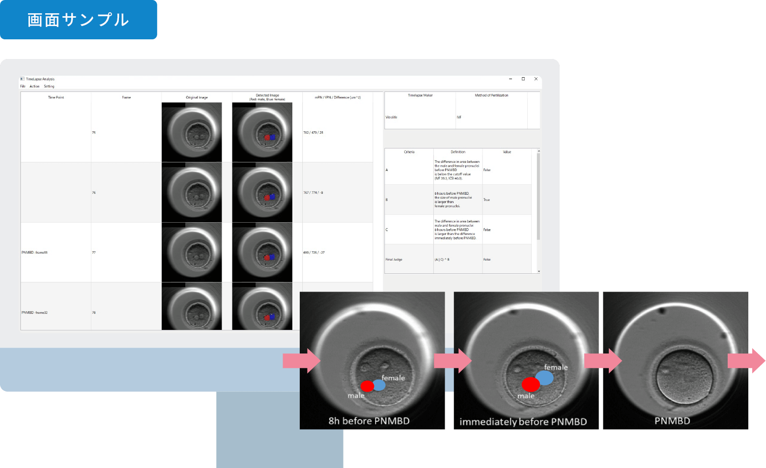 AIによる胚タイムラプス解析画面サンプル
